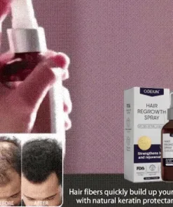 Odeiun™ Natural Hair Regrowth Spray