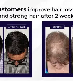 Odeiun™ Natural Hair Regrowth Spray