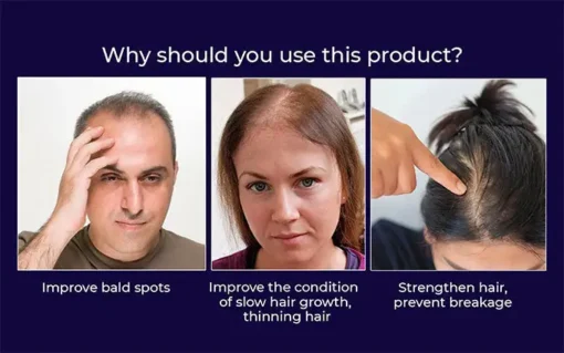 Odeiun™ Natural Hair Regrowth Spray