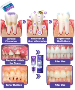 ODEIUN™ Bee Venom Dental Treatment Toothpaste