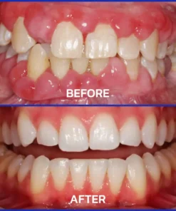 ODEIUN™ Bee Venom Dental Treatment Toothpaste