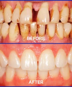 ODEIUN™ Bee Venom Dental Treatment Toothpaste