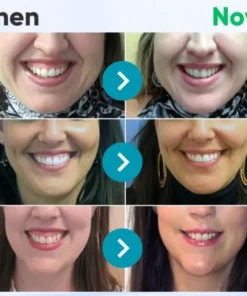 ODEIUN™ Bee Venom Dental Treatment Toothpaste