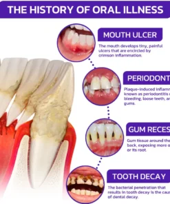 ODEIUN™ Bee Venom Dental Treatment Toothpaste
