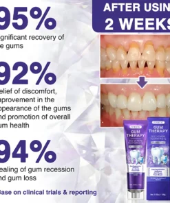 ODEIUN™ Bee Venom Dental Treatment Toothpaste