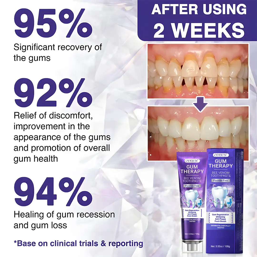 ODEIUN™ Bee Venom Dental Treatment Toothpaste