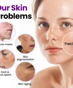 ODEIUN® Spot Erasure Probiotic Shield Serum