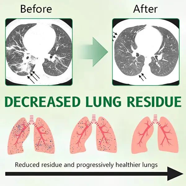 ODEIUN® 3X Concentrated Mullein Lung Cleanse Spray